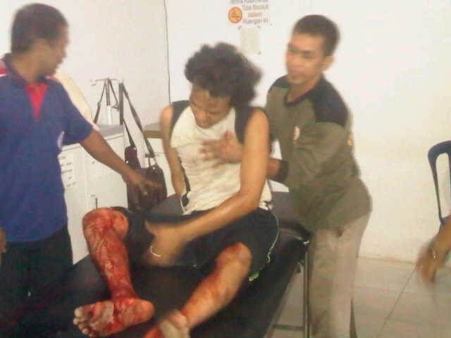 Inilah pelaku penusukan terhadap Brio Setiaji dan dua korban lainnya usai dilumpuhkan oleh aparat kepolisian